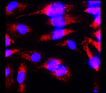 Neuroinflammation Antibody Panel