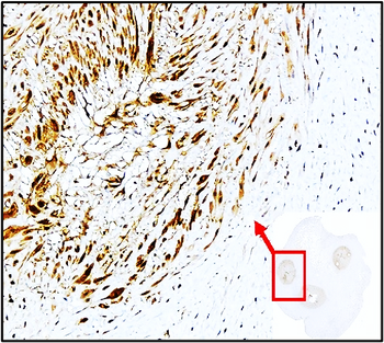 Cell Adhesion / Infiltration Antibody Panel