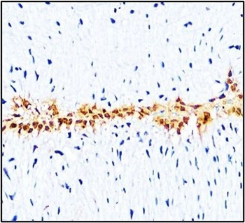 Cell Adhesion / Infiltration Antibody Panel
