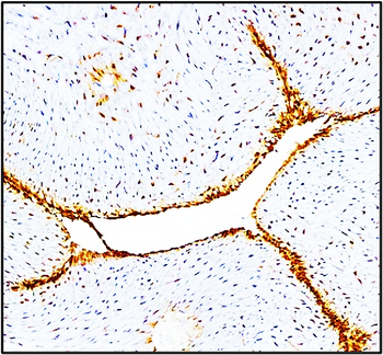 Cell Adhesion / Infiltration Antibody Panel