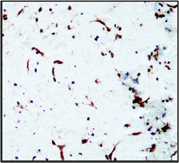 Cell Adhesion / Infiltration Antibody Panel