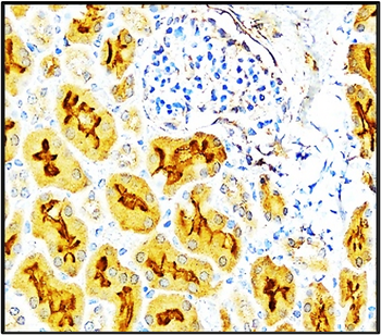 Cell Adhesion / Infiltration Antibody Panel