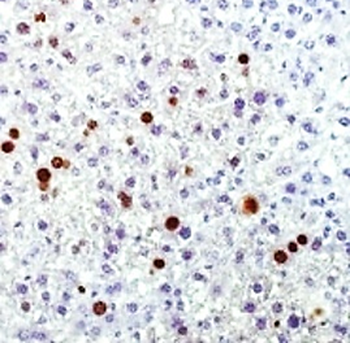 Microvascular Density Antibody Panel