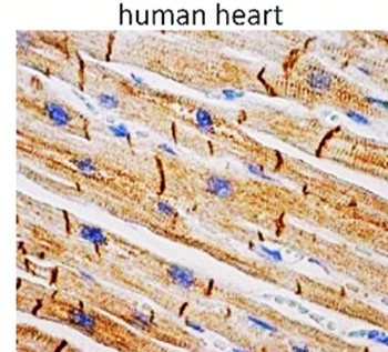 Microvascular Density Antibody Panel