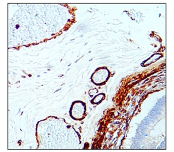 Microvascular Density Antibody Panel