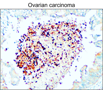 Adipogenesis Marker Antibody Panel