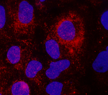 Inflammasome Antibody Panel