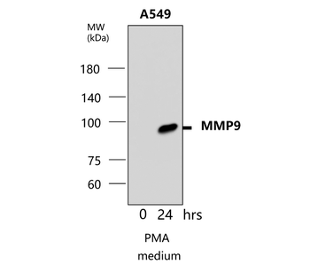 Matrix Remodeling Antibody Panel