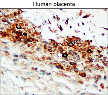 Matrix Remodeling Antibody Panel
