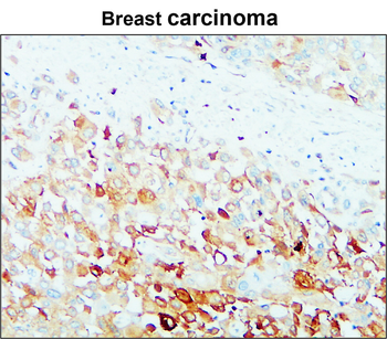 Matrix Remodeling Antibody Panel