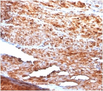 Desmin Antibody