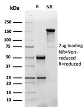 GFAP Antibody / Glial Fibrillary Acidic Protein