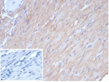 Caldesmon Antibody / CALD1 / CAD (HMW)