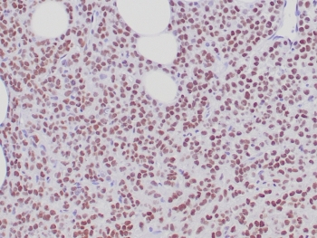 Estrogen Receptor alpha Antibody