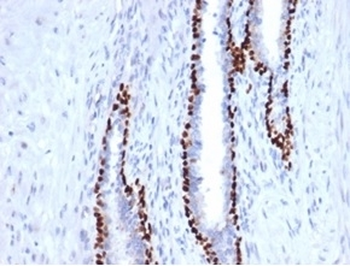 p40 / deltaNp63 Antibody