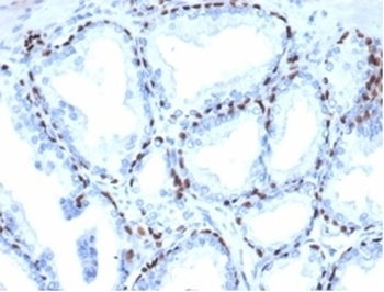 p40 / deltaNp63 Antibody