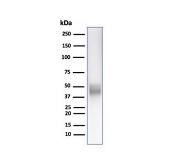 CD5 Antibody
