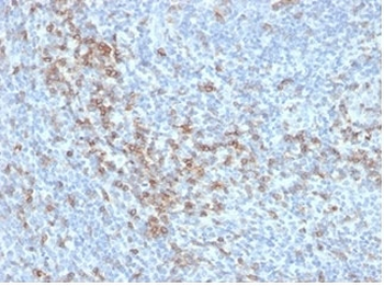 CD5 Antibody