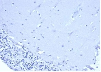 CD5 Antibody