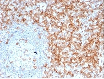 CD5 Antibody