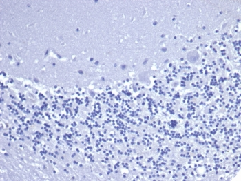 CD5 Antibody
