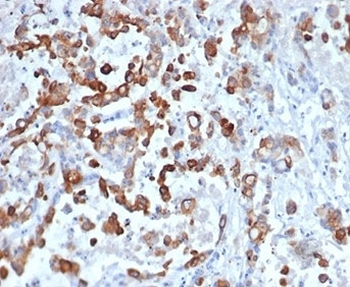 Cytokeratin 20 Antibody / CK20