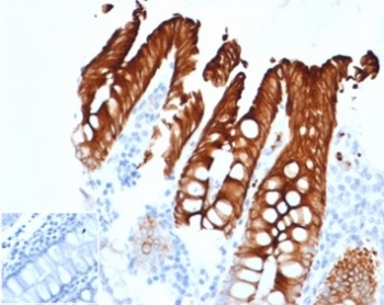 Cytokeratin 20 Antibody / CK20