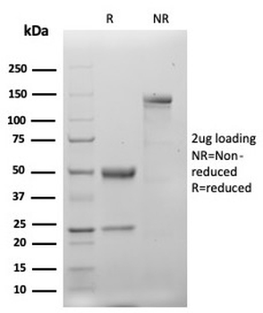 Cytokeratin 20 Antibody / CK20