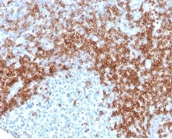 CD5 Antibody