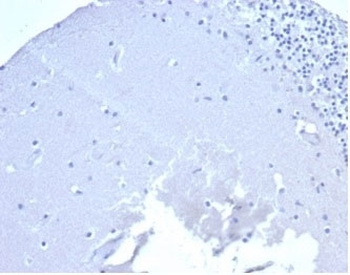 CD5 Antibody