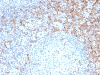 CD5 Antibody