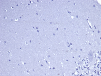 CD5 Antibody
