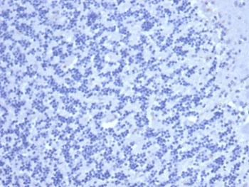 CEA Antibody / Carcinoembryonic Antigen