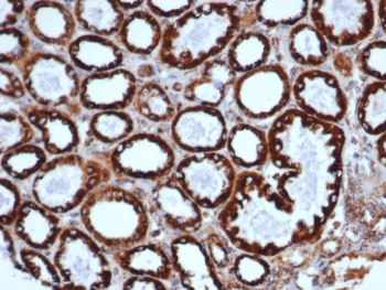 HSP60 Antibody