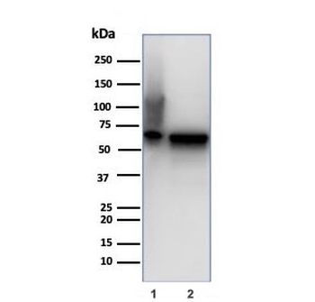 HSP60 Antibody