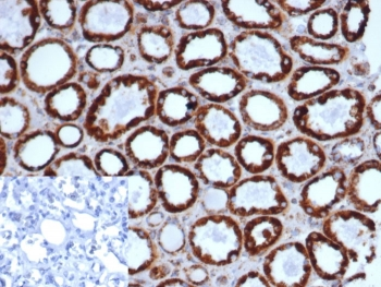 HSP60 Antibody