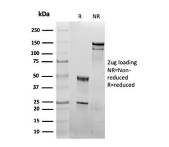 HSP60 Antibody