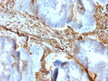 Vimentin Antibody