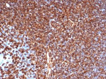 Vimentin Antibody