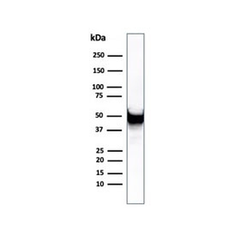 Vimentin Antibody