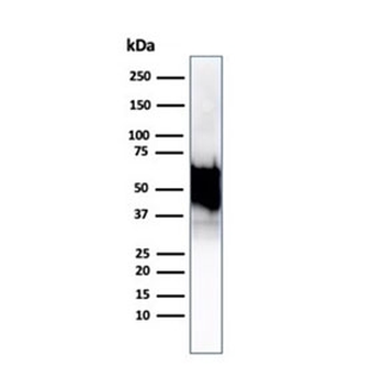 HSP60 Antibody