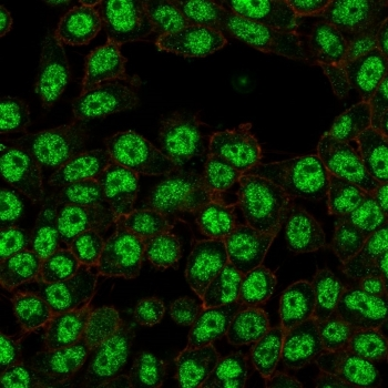 RELA Antibody / p65 NF-kB