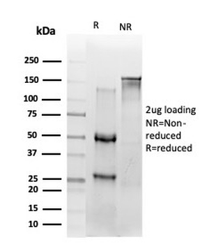 RELA Antibody / p65 NF-kB