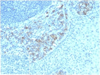 CD5 Ligand Antibody / CD5L