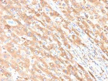 Albumin Antibody / ALB