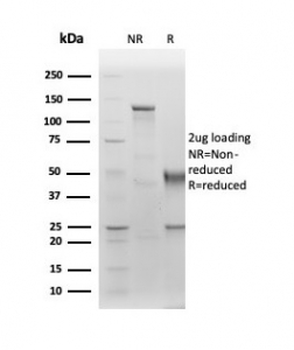 Albumin Antibody / ALB