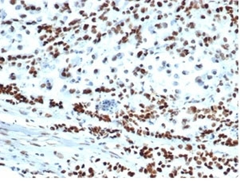 MSH6 Antibody