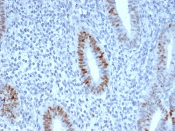 Cyclin E1 Antibody / CCNE1