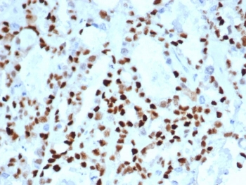 Cyclin E1 Antibody / CCNE1