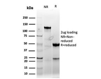 Cyclin E1 Antibody / CCNE1